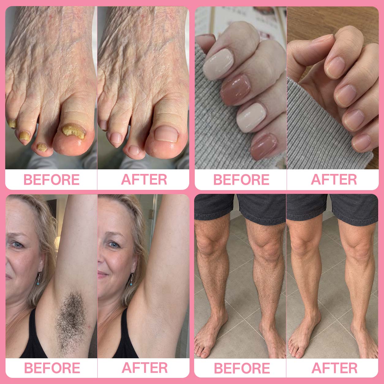 ✨Celyvon® 3-in-1 Callus, Nail & Hair Care Tool