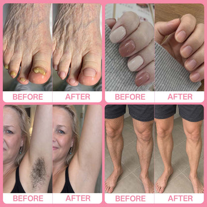 ✨Celyvon® 3-in-1 Callus, Nail & Hair Care Tool